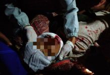 မိုးဗြဲဒေသခံ (၂)ဦး သေနတ်ပစ်ခတ်ခံရ၊ ဒဏ်ရာပြင်းထန်