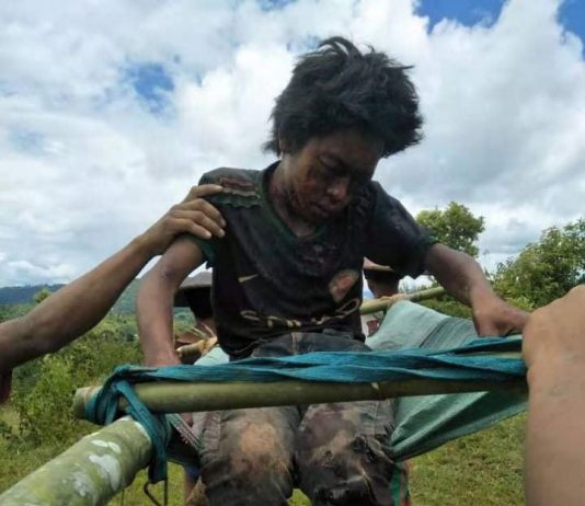 ကွတ်ခိုင်မြို့နယ် ကျွဲကျောင်းသား(၂)ဦး လက်နက်ကြီးထိမိ၊ တဦးပွဲချင်းပြီးသေဆုံ