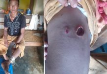 စစ်ရေးပဋိပက္ခကြား မိုင်းစနဲ့အတူသေရွာပြန် တောင်သူဦးလှဖေ