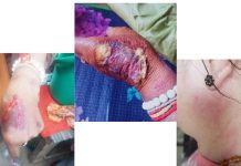 ကာလိ ပြည်သူ့စစ်အဖွဲ့မှ ဈေးသည် အမျိုးသမီး (၂)ဦးကို ရိုက်နှက်