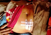 နမ့်လန်မြို့ပတ်ဝန်းကျင် တစ်ပတ်အတွင်း မိုင်းထိလူနာ (၇) ဦးရှိ