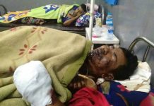 ရပ်စောက်မှာ တောင်ယာ မီးရှို့ချိန် ပေါက်ကွဲမှုဖြစ် အမျိုးသားတစ်ဦး ပြင်းထန်ဒဏ်ရာရ