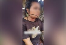 မိုင်းကိုင်မြို့နယ် အမျိုးသမီးတစ်ဦး လုယက်ခံရပြီး ထိခိုက်ဒဏ်ရာရ