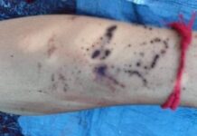 ကျိုင်းတုံမြို့နယ် ဆယ်အိမ်မှူးတစ်ဦး သေနတ်ပစ်ခံရ