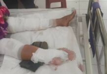 ဆီဆိုင်မြို့နယ်တွင် အမျိုးသမီးတစ်ဦး ဟင်းရွက်ခူးရာမှ မြေမြှုပ်မိုင်းနင်းမိ၊ ခြေတစ်ဖက်ဆုံးရှုံး